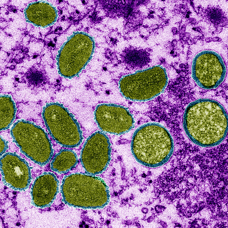 Brasil confirma mais dois casos de varíola dos macacos